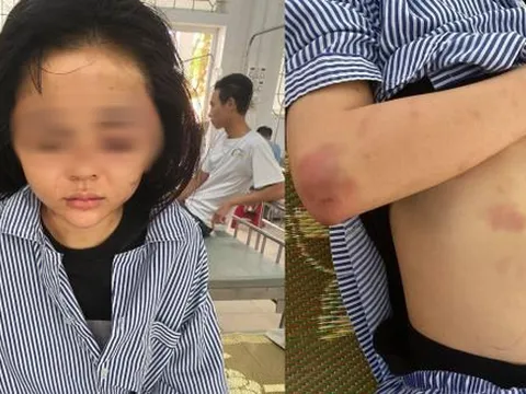 Gã đàn ông xăm trổ 'tra tấn' cô gái suốt 2 tiếng đồng hồ đối mặt với hình phạt nào?